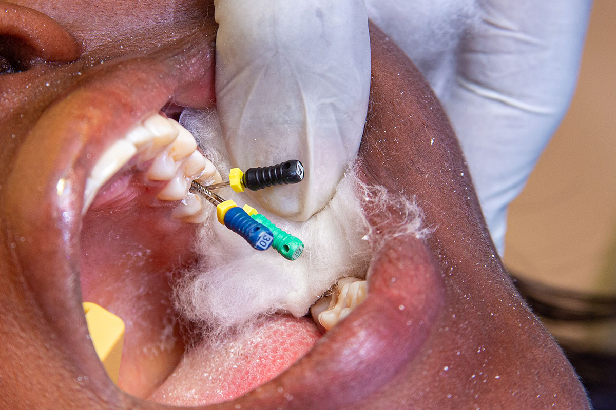 endodontie